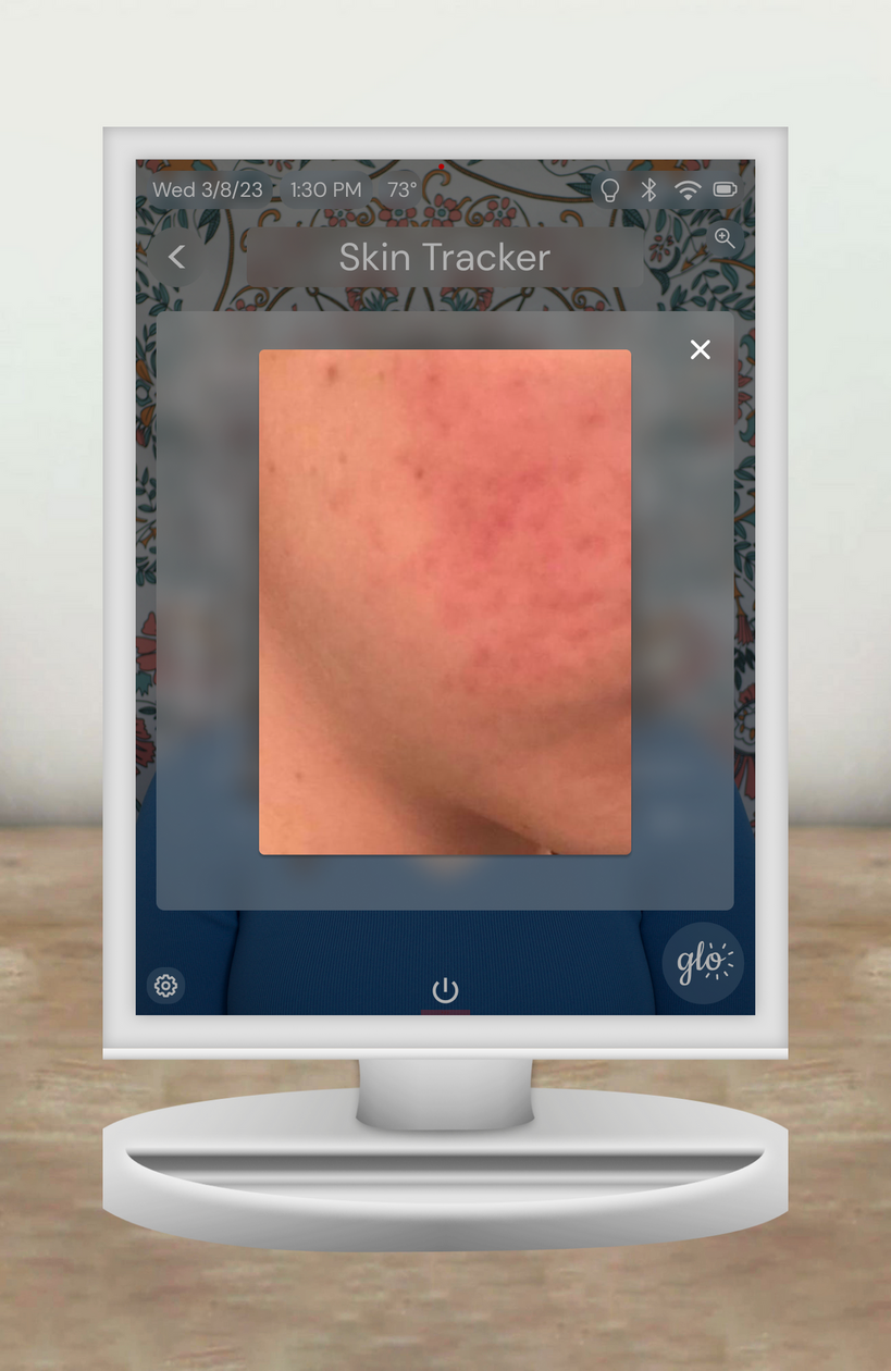 Skin Tracker Design 3